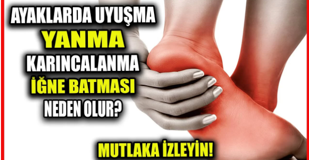 Ayaklarda Yanma A’ğrı Sebepleri ve T’edavi Yöntemleri..