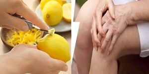 Dinmeyen Eklem A’ğrılarını Limon Kabuğuyla T’edavi Edin Ba’kın Nasıl mı?