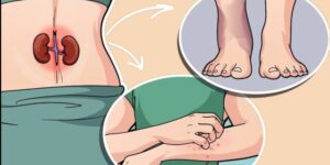 Toplumda sık görülen böbrek hastalıkları çoğu zaman fark edilmeden ilerliyo