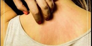 K-a’n ser Olduğunu İlk Gün Anla! İş’te O Belirtileri…