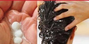 Saçınıza 3 aspirin sürün 5 dakika bekleyin, v’eda edin! İ’laç değil: