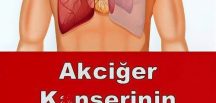 Akciğer K’an serinin En Sinsi 9 Bulgusu