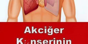 Akciğer K’an serinin En Sinsi 9 Bulgusu